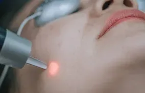 Laser skin clinic Coimbatore service image