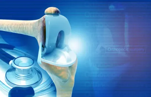 JOINT REPLACEMENT SURGERIES service image