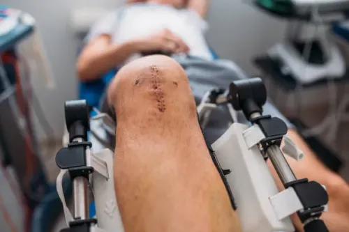 Knee Surgery service image