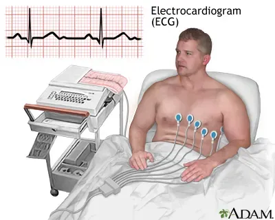 ECG Test in Erandwane, Pune service image