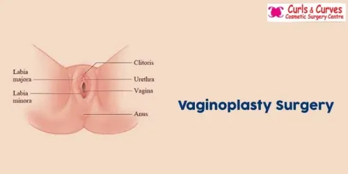 Vagina Tightening Surgery service image