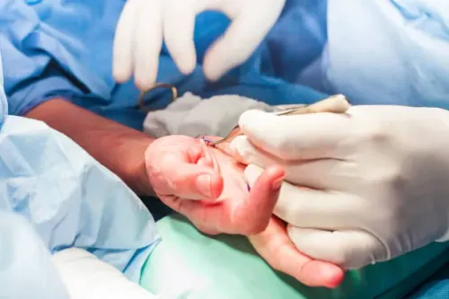Reconstructive Hand & Wrist Surgery service image