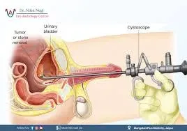 UROLOGY SURGERY service image