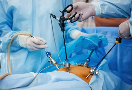 Laparoscopy service image