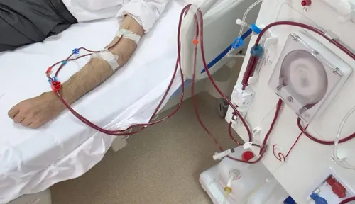DIALYSIS service image