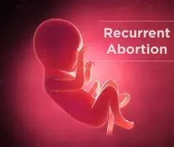 Miscarriages service image