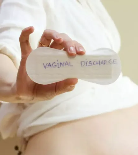Vaginal discharge  service image