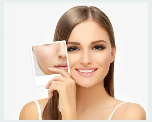 Acne Treatment Specialist in Bibwewadi, Kondhwa, Dhankawadi, Pune service image
