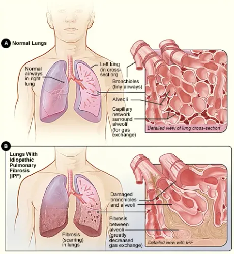 Advanced Lung Failure Management service image