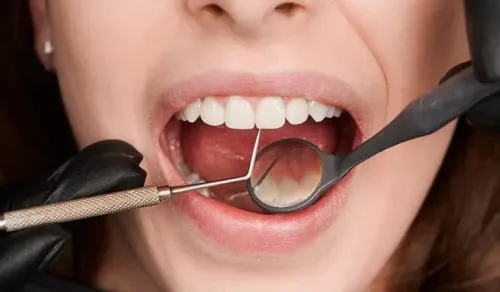 Advance Gum Treatment service image