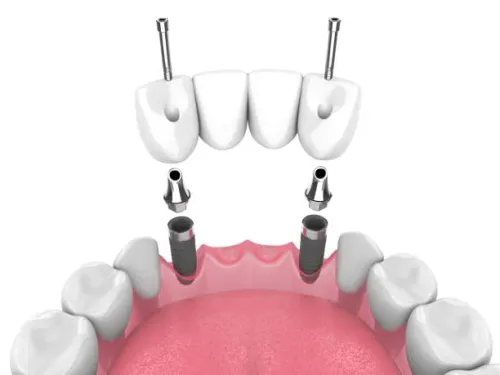Bridges & Crown service image