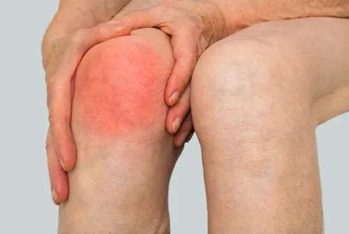 Infected Knee Joints service image
