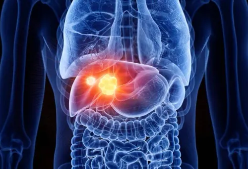 Liver Cancer Surgery service image
