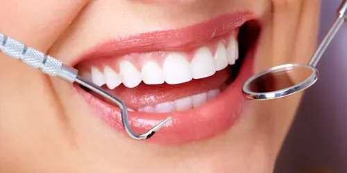 Dental Checkup (Inc. Scaling Polishing Etc.) service image