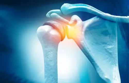 Arthroscopic Surgery of Shoulder product image