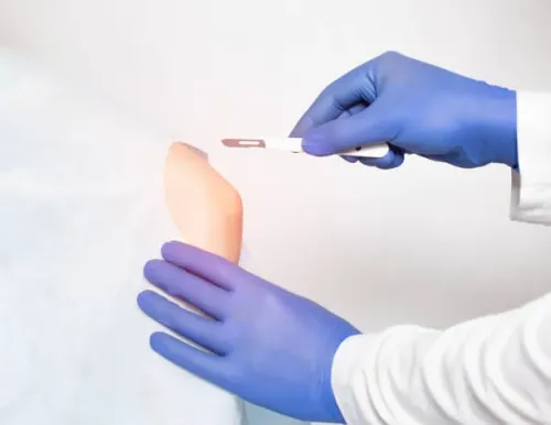 Arthroscopic Surgery of Elbow product image
