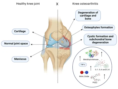 Osteoarthritis Treatment service image