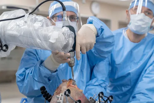 Robotic Knee Replacement Surgery service image