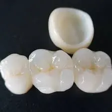 Crowns & Bridges service image