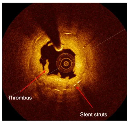 Optical Coherence Tomography (OCT) in Erandwane, Pune service image