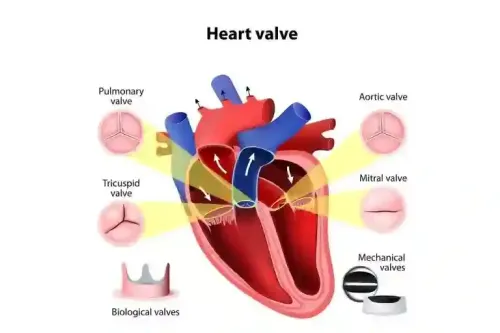 Valve Replacement Surgery in Erandwane, Pune service image