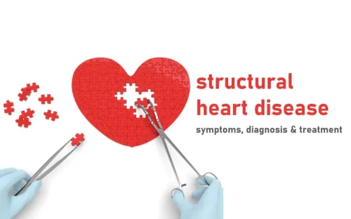 Structural Heart Disease Treatment in Erandwane, Pune service image