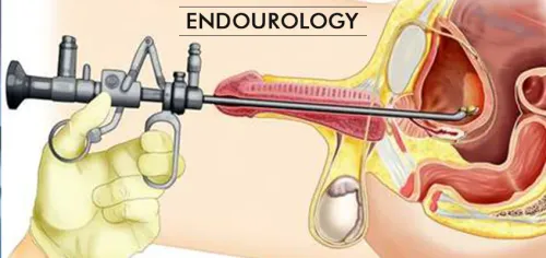 Endourology Treatment in Moshi PCMC Pune service image