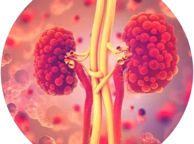 Urological Cancers Surgeon in Mumbai service image