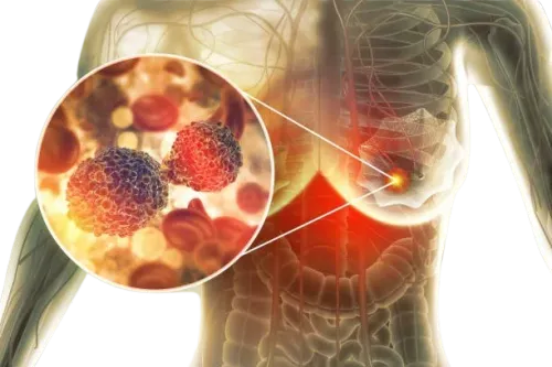 Breast Cancer Surgeon in Mumbai service image
