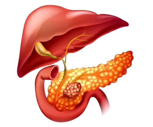Hepatopancreaticobiliary Cancers Surgeon in Mumbai service image