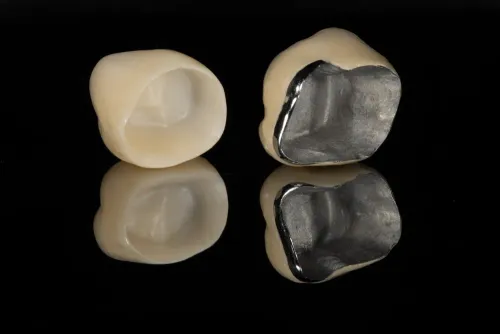 Ceramic  Crown Cap treatment in Kharadi , Wadgaon Sheri service image