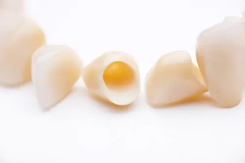 Fully Ceramic Crown Cap treatment in Kharadi , Wadgaon Sheri service image