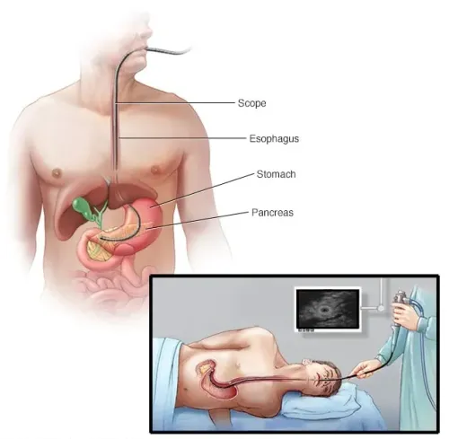 Endoscopic Interventions in Moshi service image
