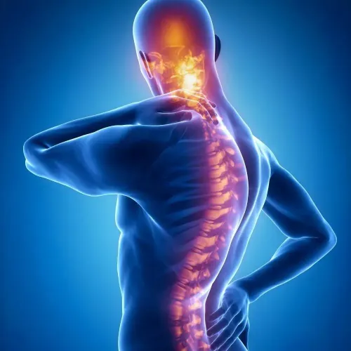 Ayurvedic and Panchakarma treatments for spinal disorders service image