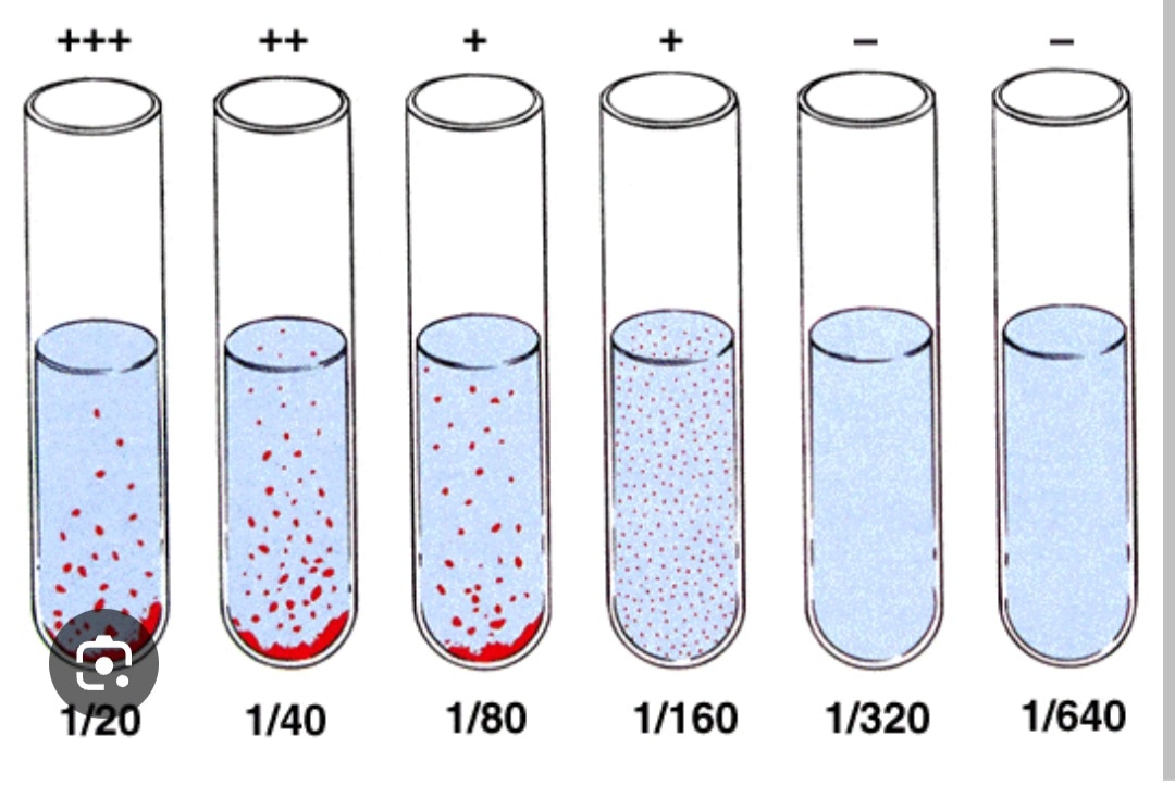 A85➡️Widal By Tube Method