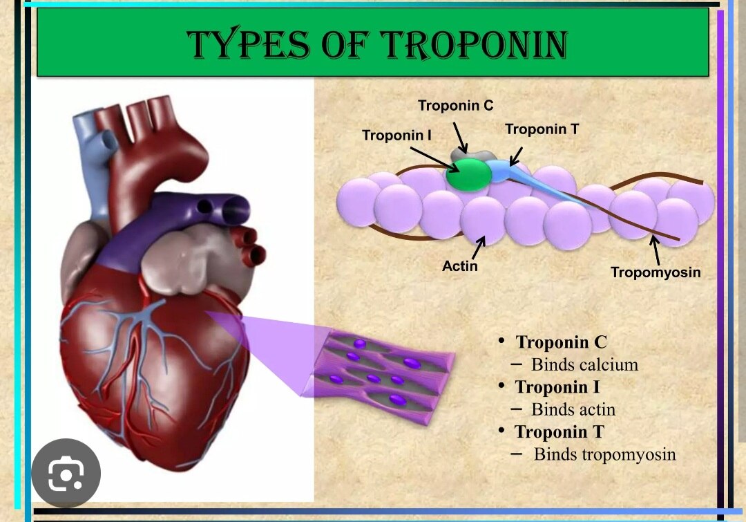 A97➡️Troponin I 