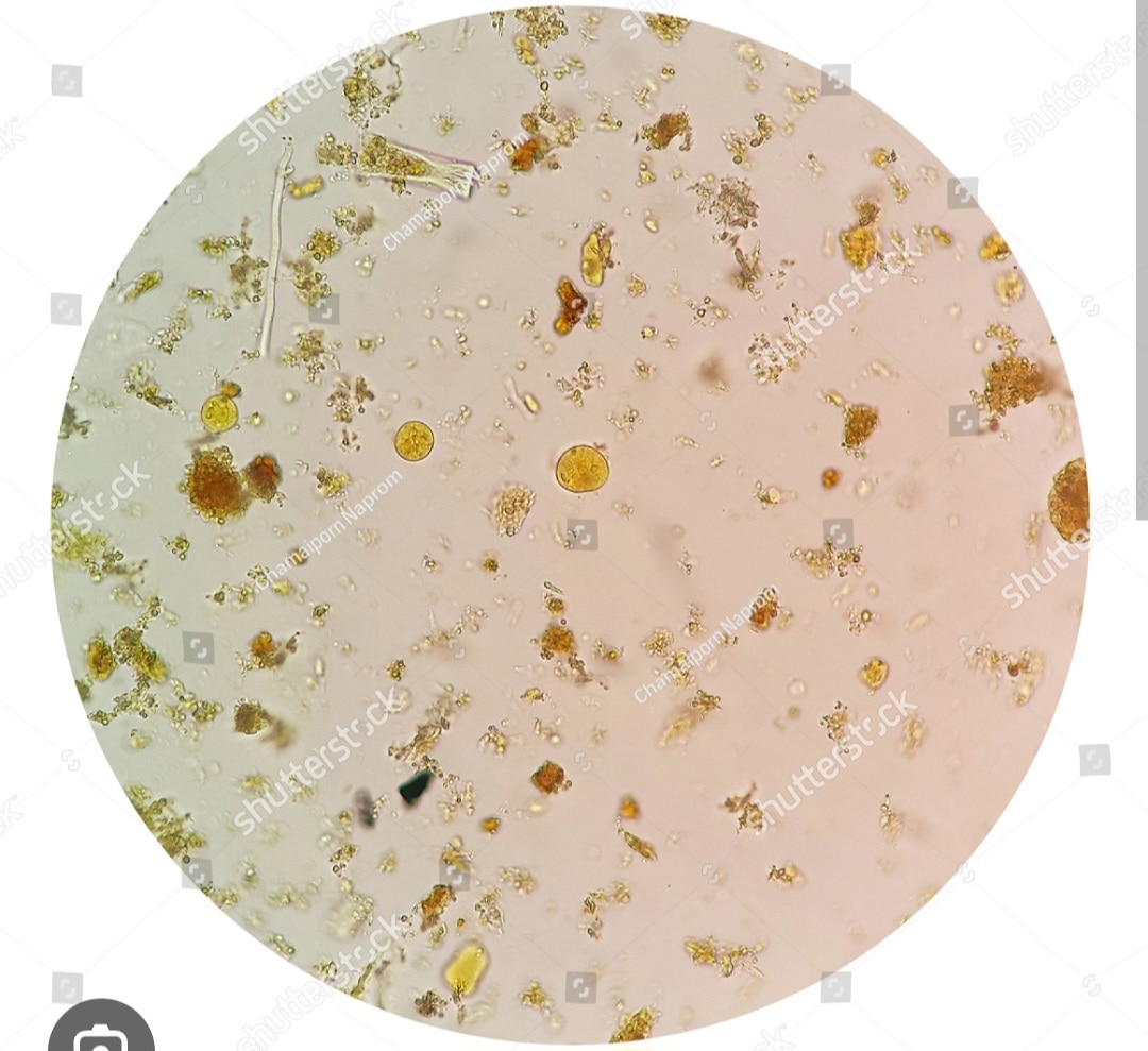 A100➡️Stool Routin Microscopy 