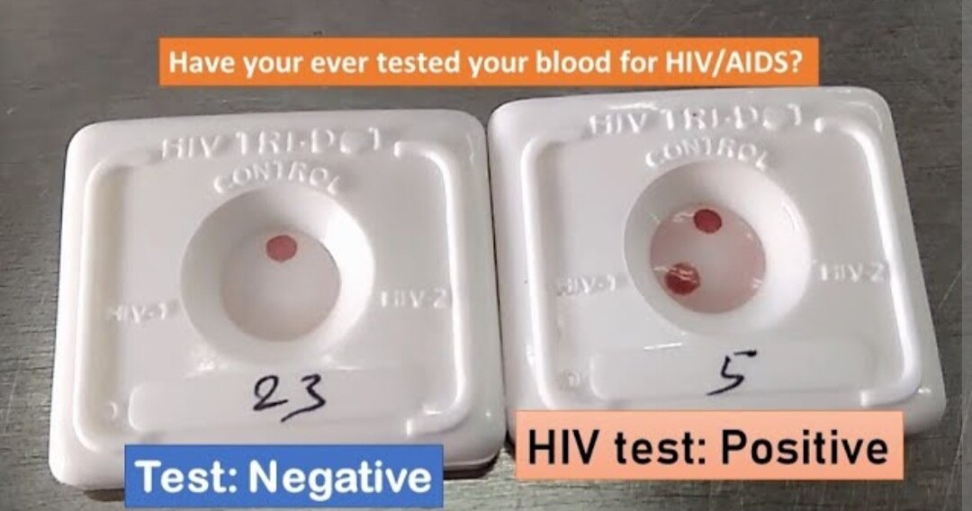 A117➡️HIV 