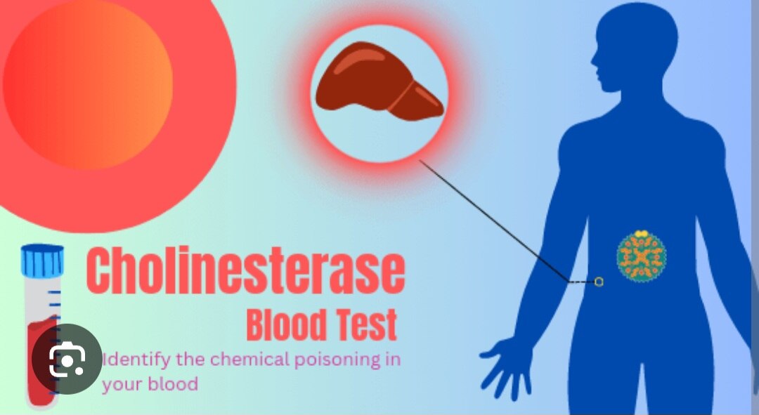 A130➡️cholinesterase