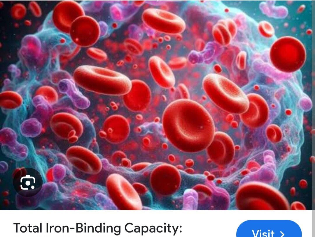 A144➡️TIBC (Total Iron-Binding Capacity)