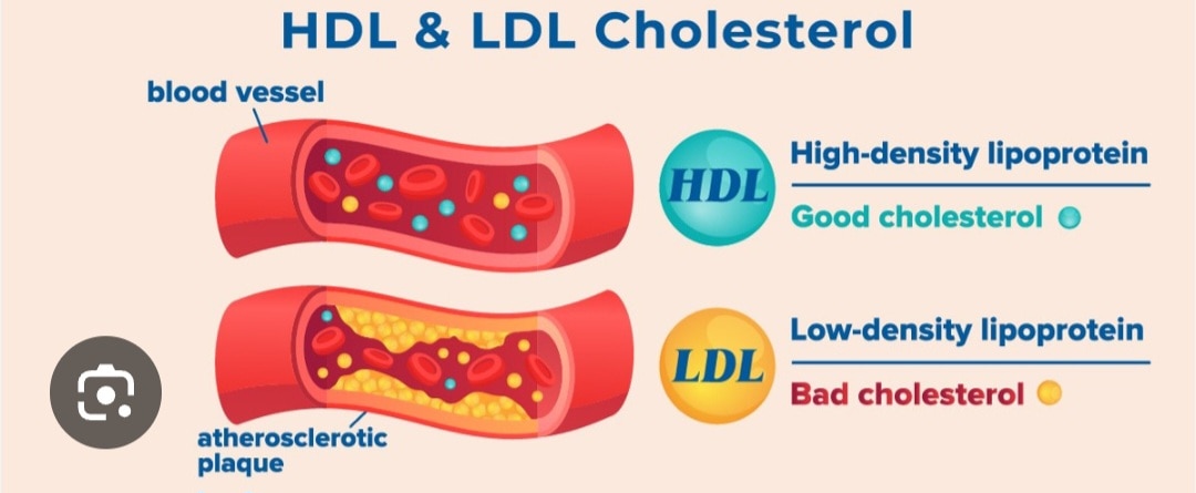 A152➡️HDL cholesterol 