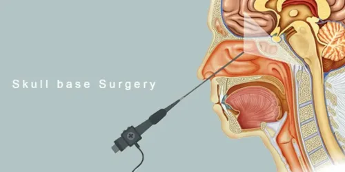  Skull Base Surgery service image