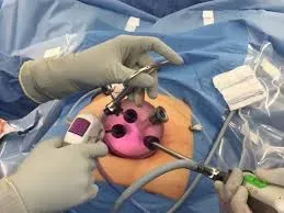 Gynaec Onco Surgery service image