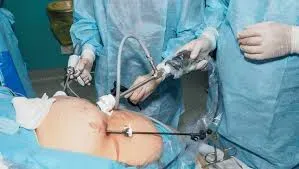 Gynaec Laparoscopic Surgery service image