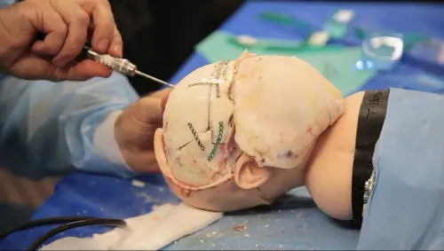 Pediatric Neuro Surgeries service image