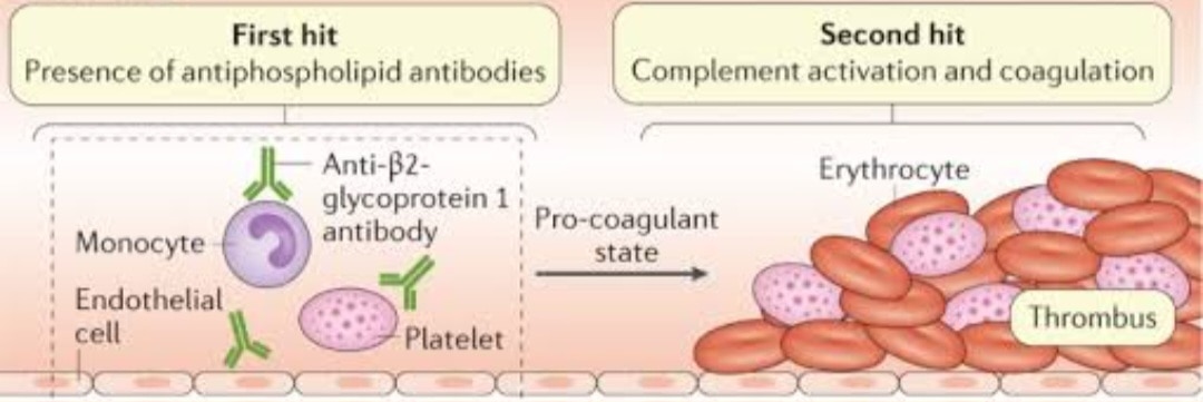 A171➡️Anti phospholipid antibody (APLA) IGM