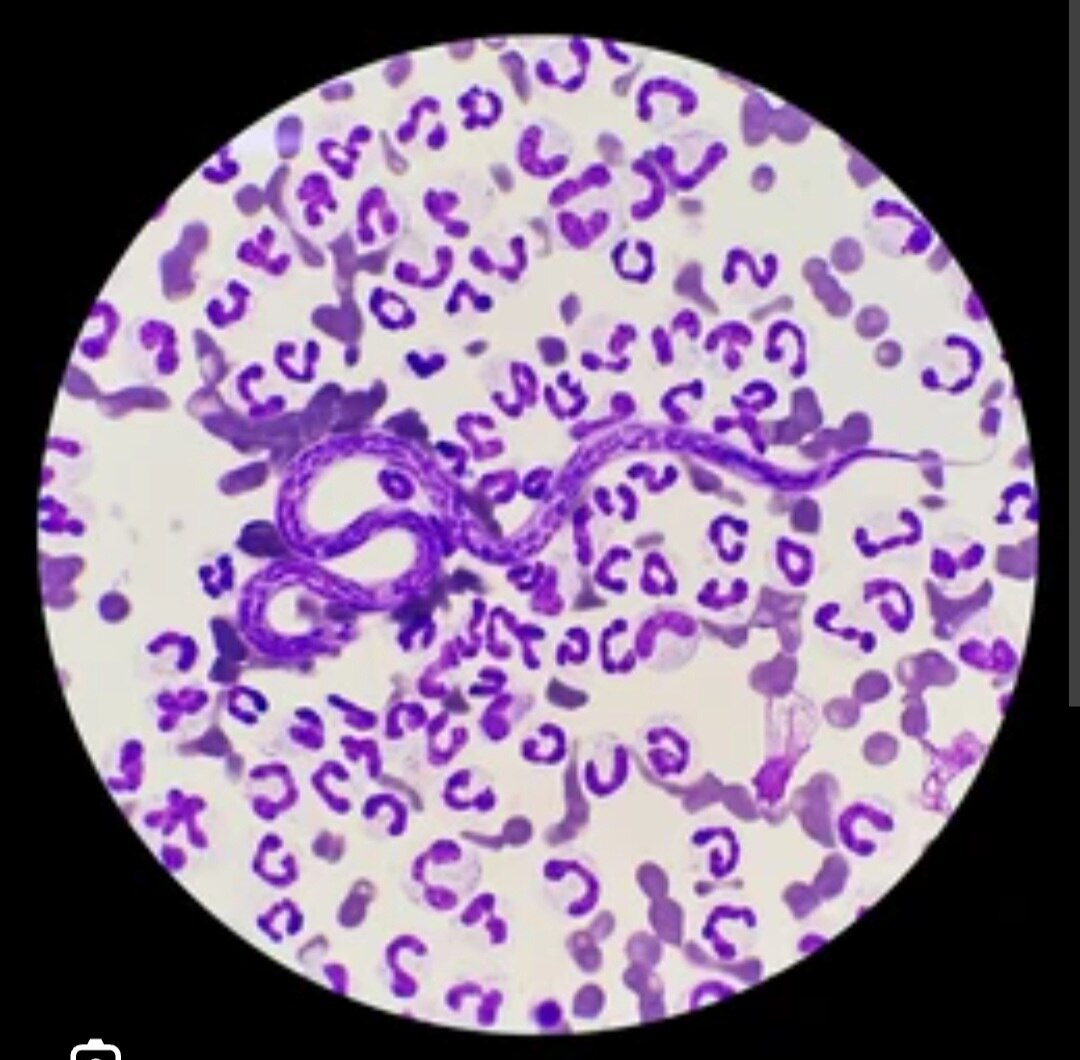 A219➡️filaria antibody 