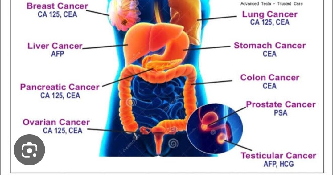 A224➡️CEA (Carcinoembryonic Antigen) 