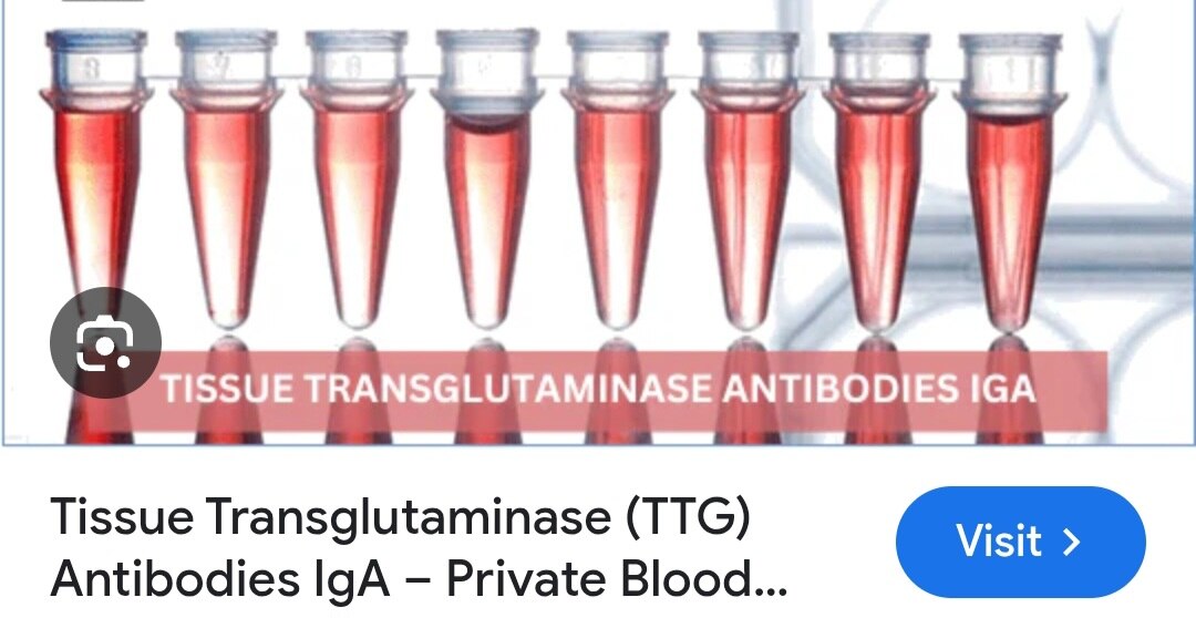 A234➡️TTG IgG 