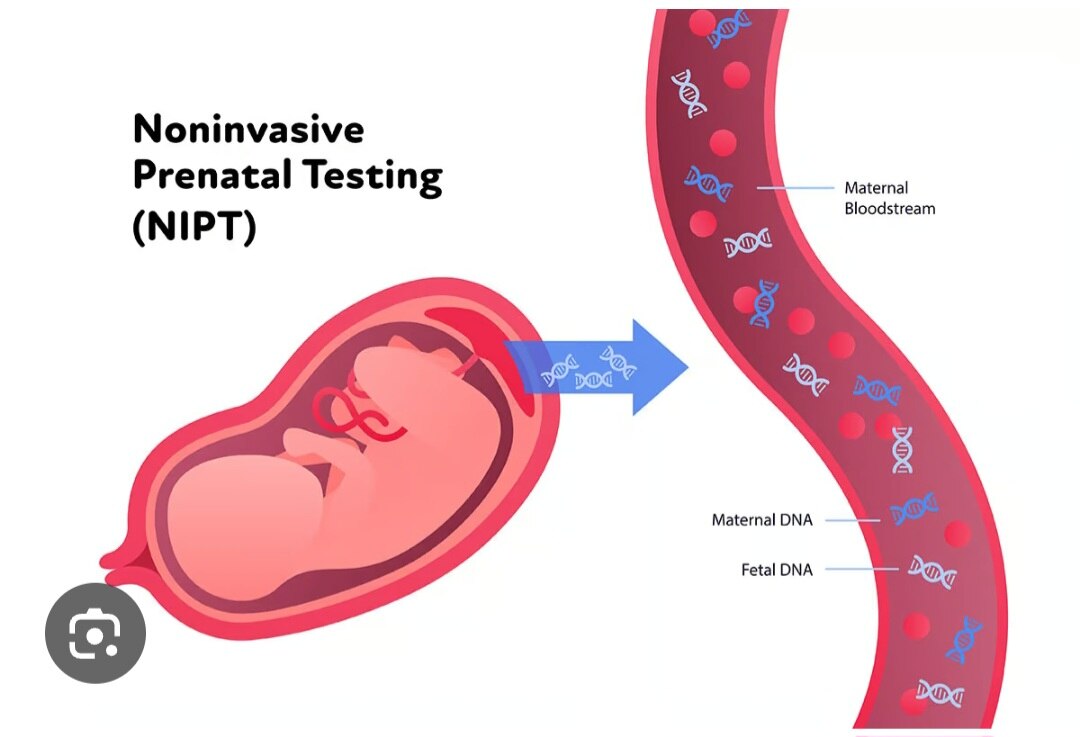 A252➡️NextGen NIPT Advance (Non-Invasive Prenatal Screening Advance),Blood